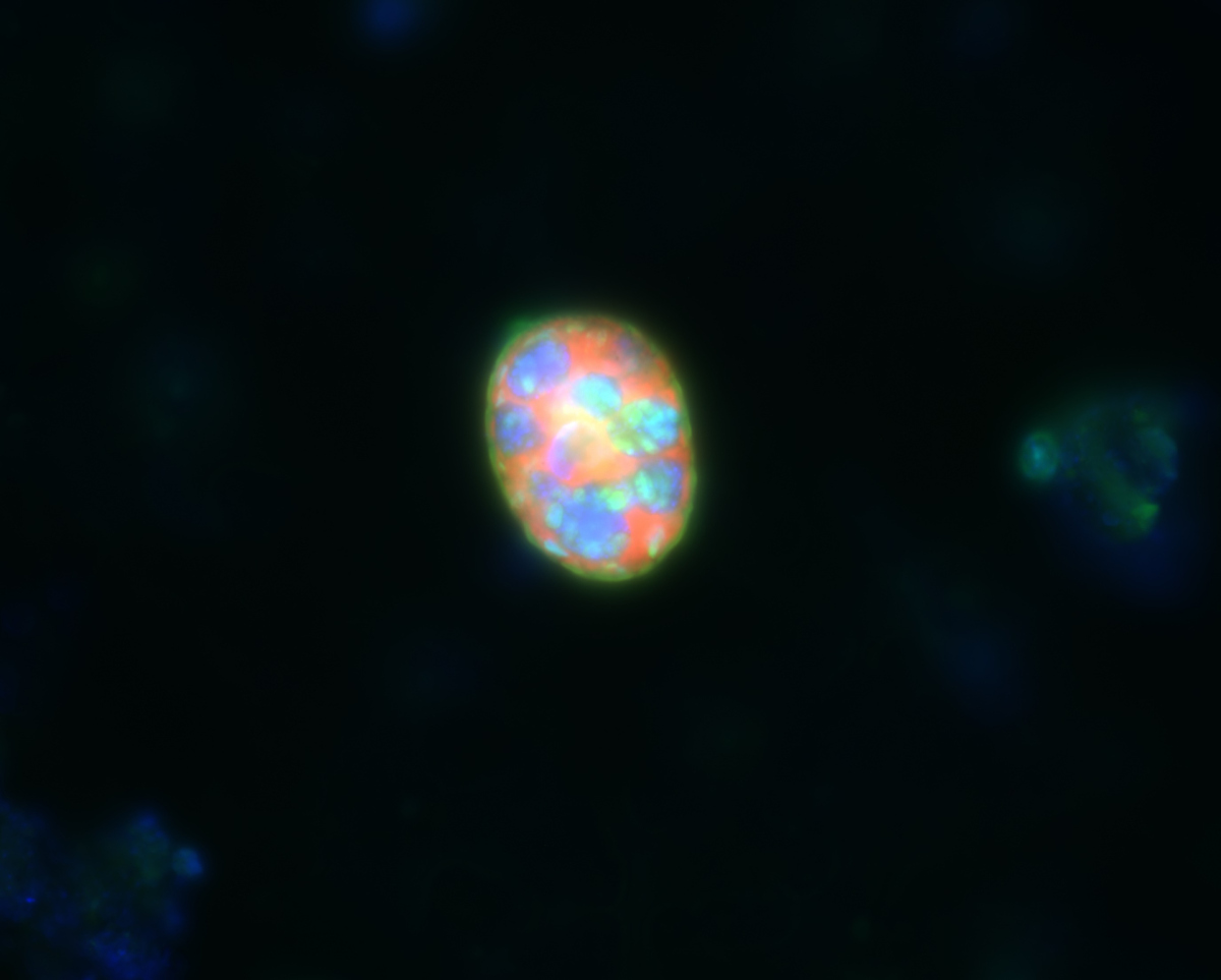 FISH picture of a ciliate with denitrifying endosymbionts FISH picture of a ciliate with denitrifying endosymbionts