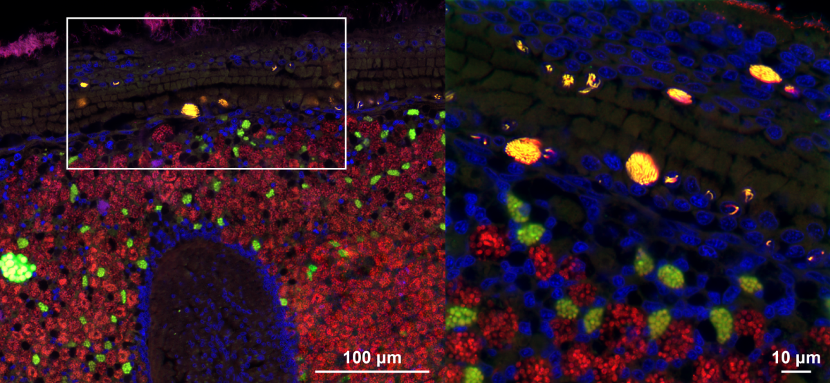 Microscopy image (fluorescence in situ hybridization (FISH) confocal microscopy) of tissues from a deep-sea mussel showing the intranuclear parasite Ca. Endonucleobacter in yellow, and the beneficial symbiotic bacteria in green and red. Cell nuclei are stained blue. The right panel is a zoom-in of the white square in the left panel. (© Miguel Angel Gonzalez-Porras/Max Planck Institute for Marine Microbiology) Microscopy image (fluorescence in situ hybridization (FISH) confocal microscopy) of tissues from a deep-sea mussel showing the intranuclear parasite Ca. Endonucleobacter in yellow, and the beneficial symbiotic bacteria in green and red. Cell nuclei are stained blue. The right panel is a zoom-in of the white square in the left panel. (© Miguel Angel Gonzalez-Porras/Max Planck Institute for Marine Microbiology)