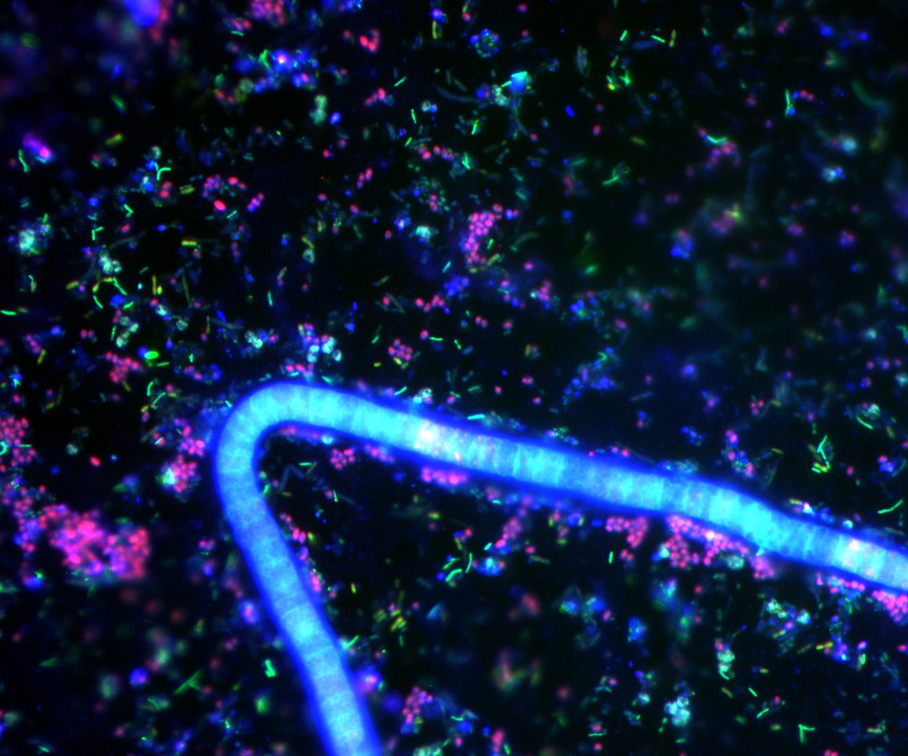 Das Fluoreszenz-Bild einer Probe zeigt deutlich die verschiedenen Arten in ihrer spezifischen Farbe. Das Fluoreszenz-Bild einer Probe zeigt deutlich die verschiedenen Arten in ihrer spezifischen Farbe.
