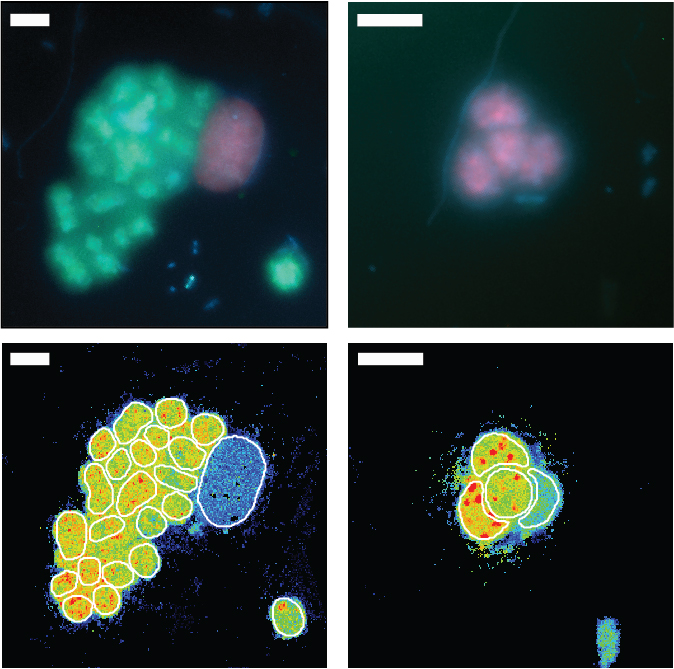 Autofluorescence of Dolichospermum Autofluorescence of Dolichospermum
