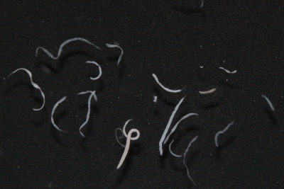 Several Kentrophoros ciliates from the Mediterranean Sea under the microscope Several Kentrophoros ciliates from the Mediterranean Sea under the microscope