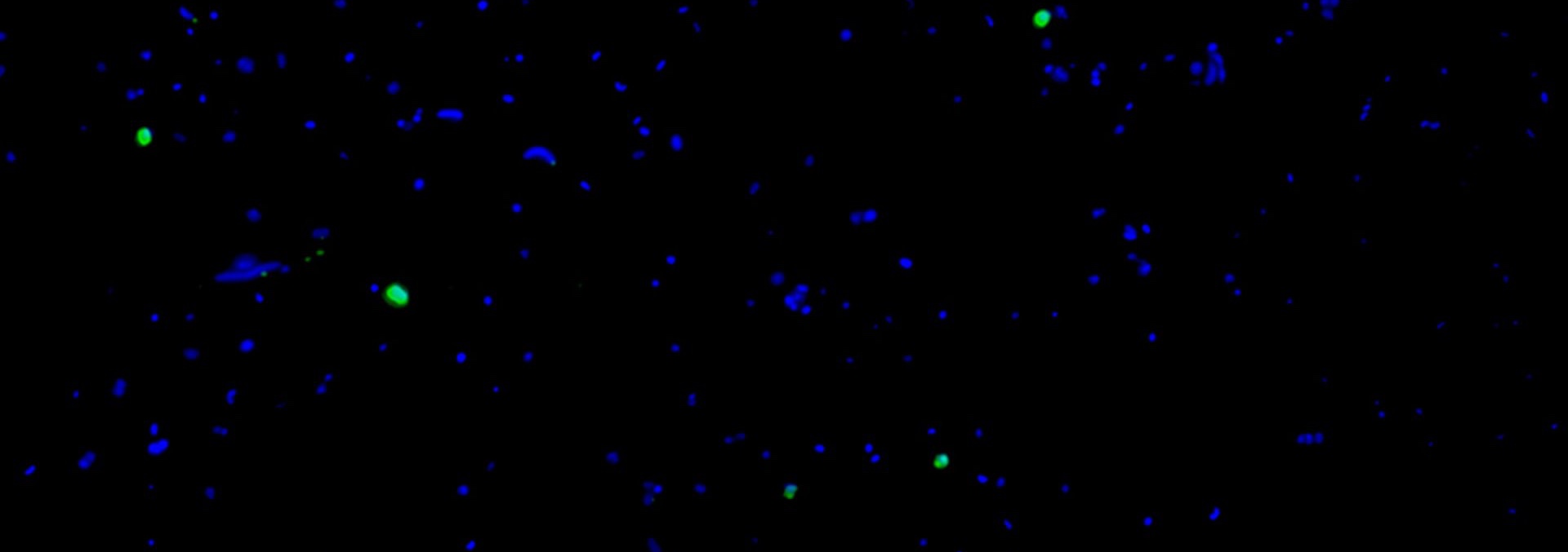 Nitrococcus Benguela upwelling-small