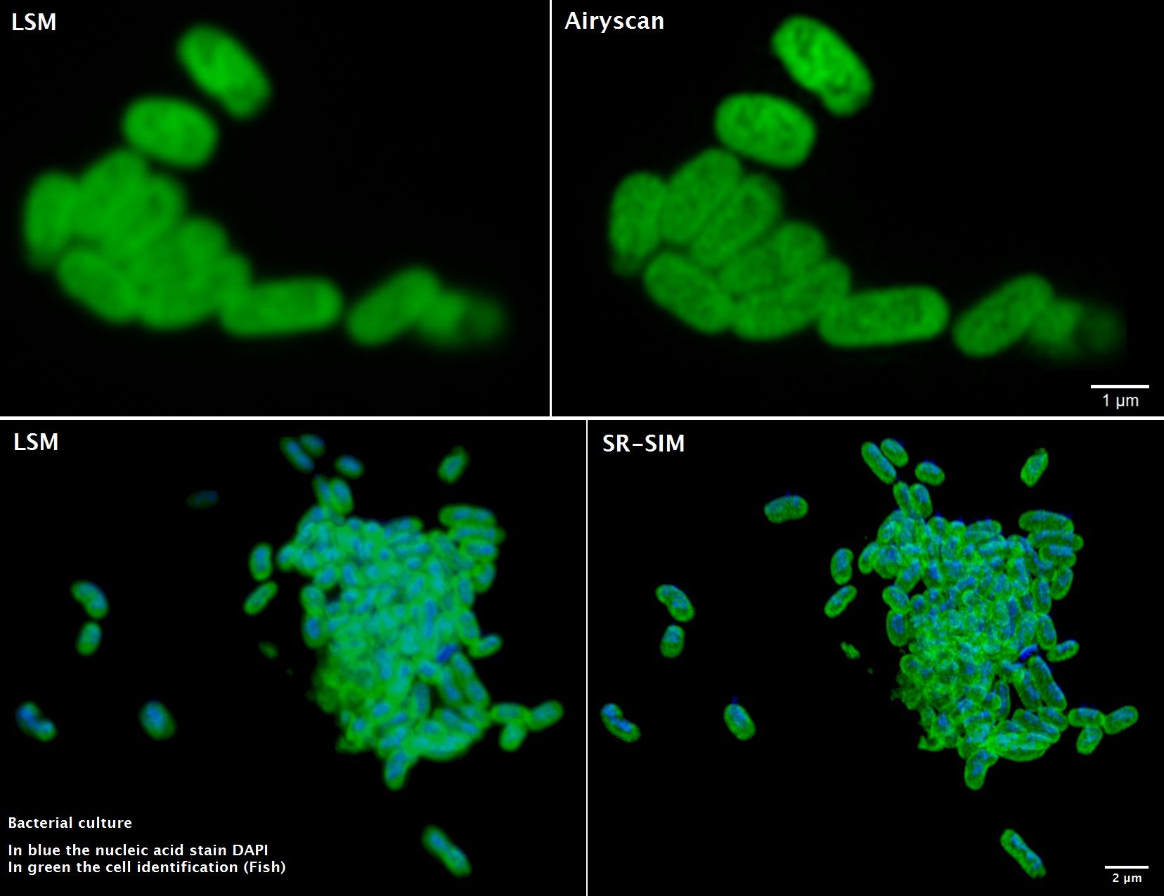 Comparison LSM Airyscan SR-SIM