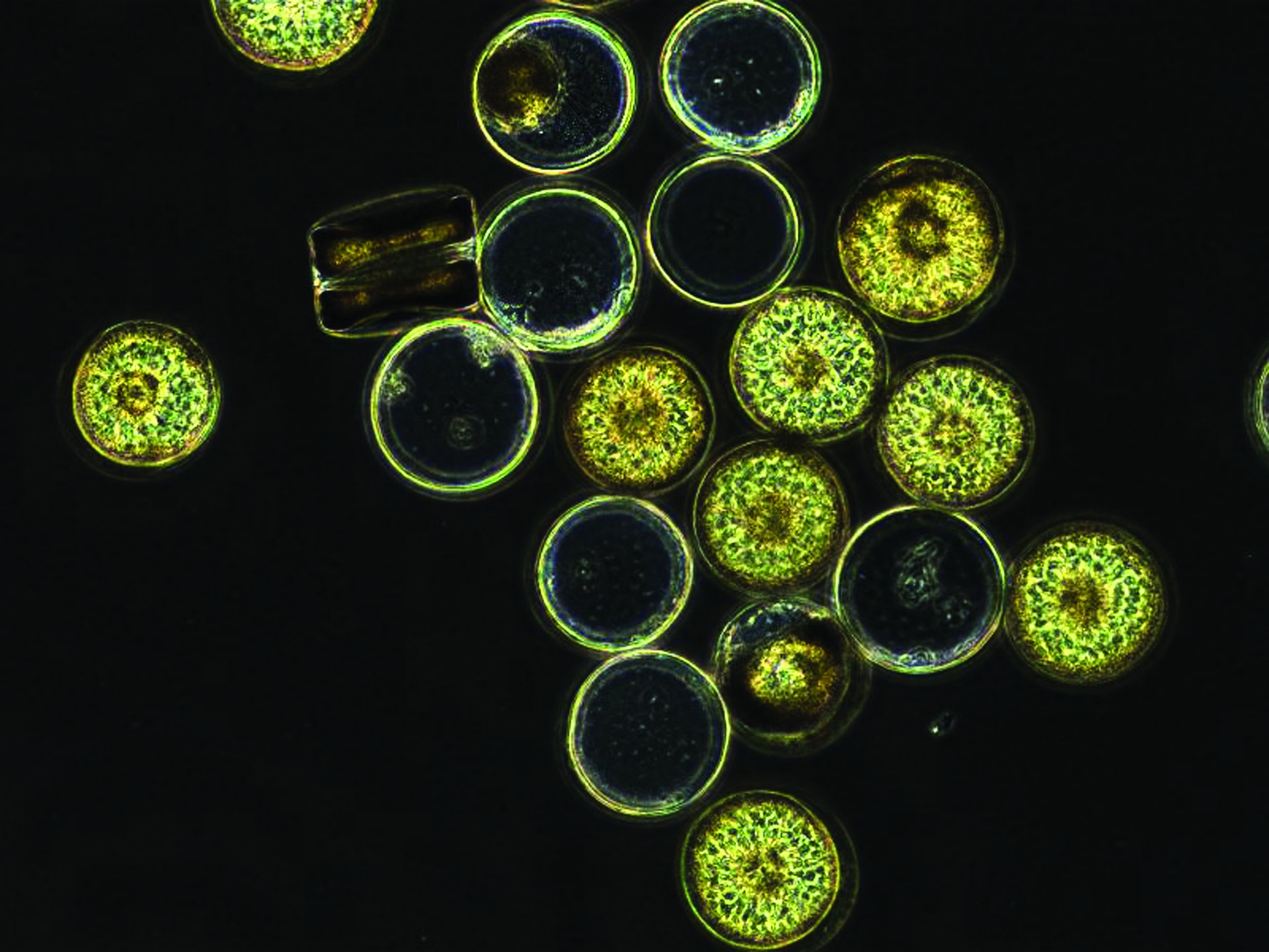Algen (Coscinodiscus) unter dem Mikroskop (© Craig Stephan Robb, Max-Planck-Institut für Marine Mikrobiologie Bremen)