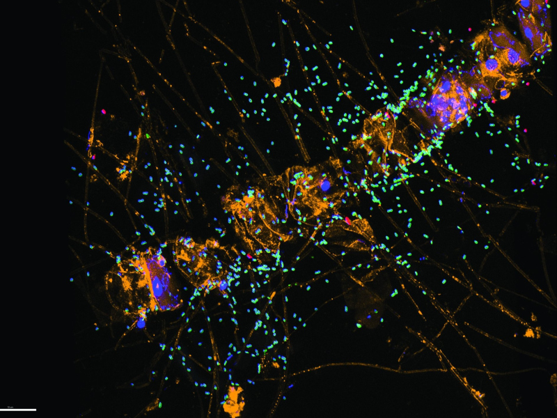 Fluoreszenzmikroskopische Aufnahme eine winzigen Alten (© Max-Planck-Institut für Marine Mikrobiologie / I. Bakenhus)