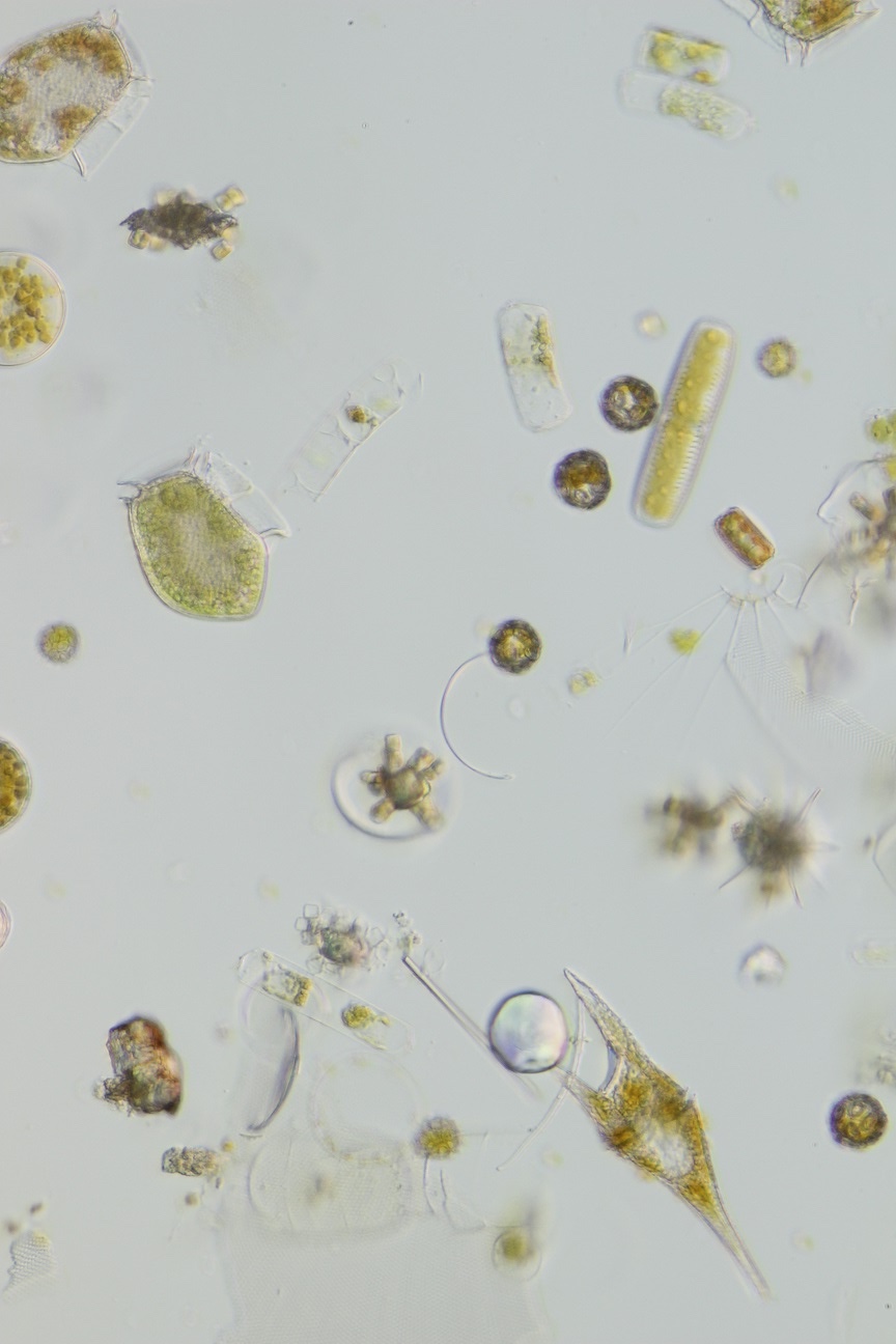 Mikroskopischer Blick in eine Phytoplanktonprobe. Foto: MARUM, Universität Bremen