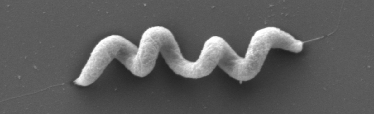 Scanning electron microscope image of Magnetospirillum gryphiswaldense. Scanning electron microscope image of Magnetospirillum gryphiswaldense.