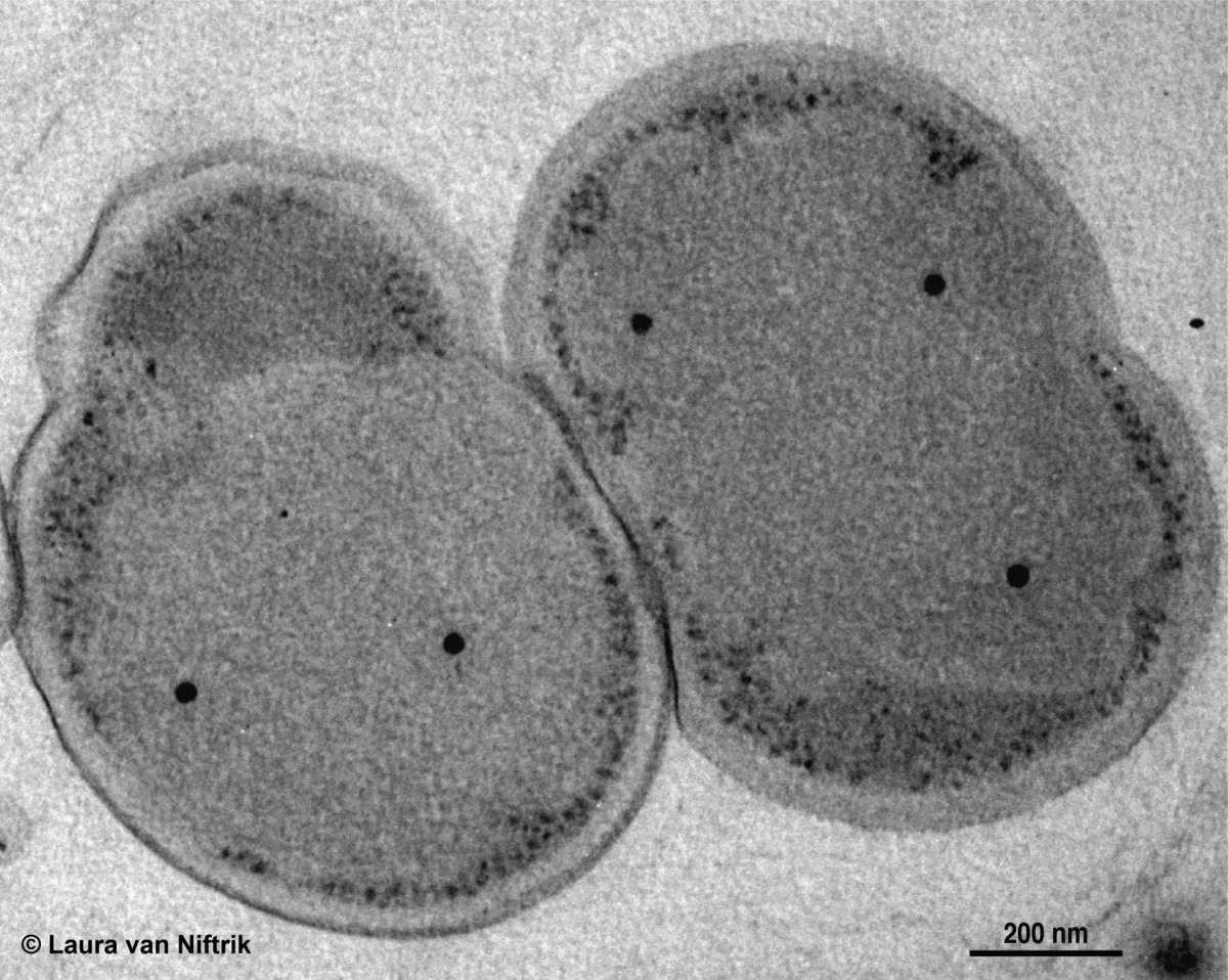 Kuenenia stuttgartiensis, here seen under a transmission electron microscope, is a model anammox microorganism, which grows as single cells. It is a freshwater species also found in wastewater treatment plants. © Laura van Niftrik