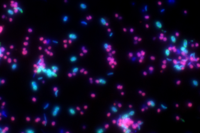 This fluorescence microscopy image shows Candidatus Argoarchaeum ethanivorans in magenta, and the sulfate-reducing bacteria in cyan. © Niculina Musat / UFZ