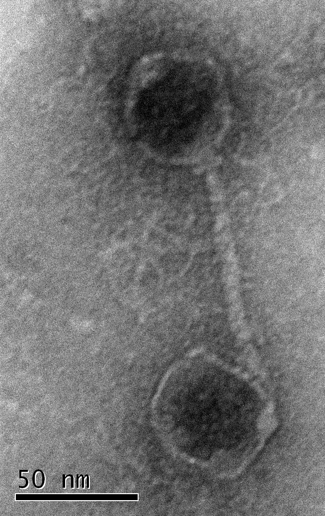 Electron microscopy image of a virus particle attached to a membrane vesicle. (© Susanne Erdmann)  