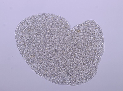 Looks like a potato chip: Trichoplax under the microscope. (© Harald Gruber-Vodicka / Max Planck Institute for Marine Microbiology) Looks like a potato chip: Trichoplax under the microscope. (© Harald Gruber-Vodicka / Max Planck Institute for Marine Microbiology)