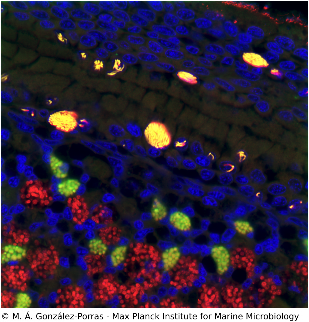 FISH image of Bathymodiolus mussel infected with Ca. Endonucleobacter (yellow). FISH image of Bathymodiolus mussel infected with Ca. Endonucleobacter (yellow).