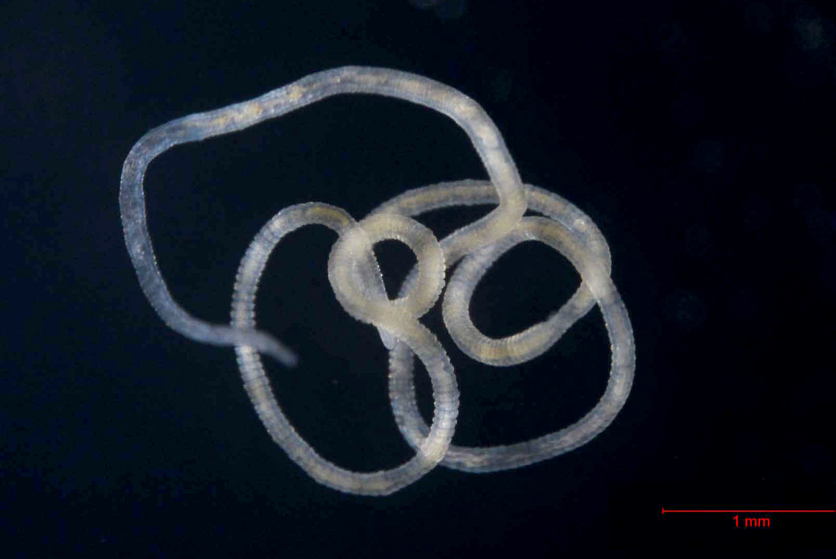 Olavius unter dem Mikroskop (© Max-Planck-Institut für Marine Mikrobiologie/ S. Paulsen)