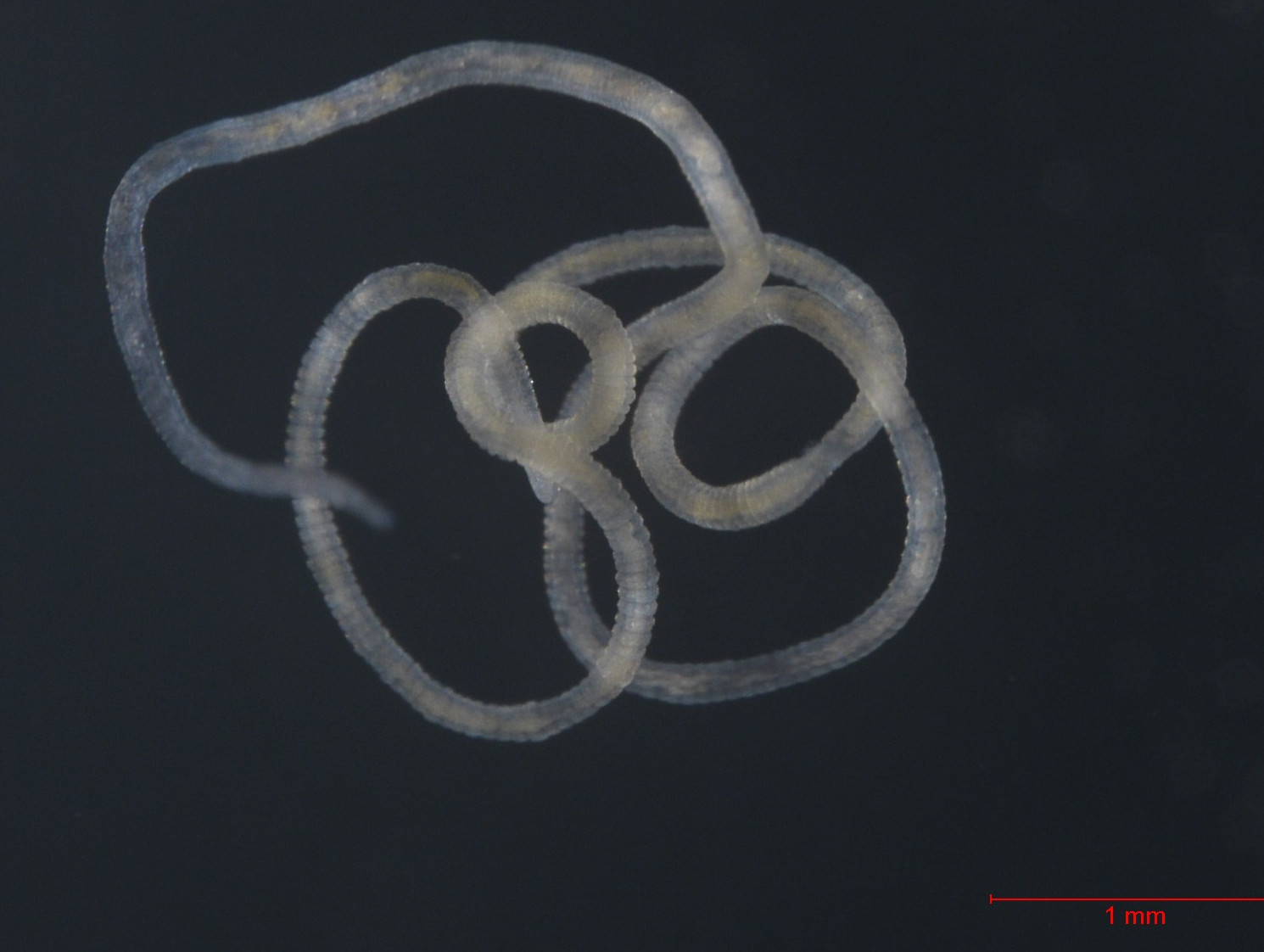 Da ist er: Olavius unter dem Mikroskop. (© Max-Planck-Institut für Marine Mikrobiologie/ S. Paulsen