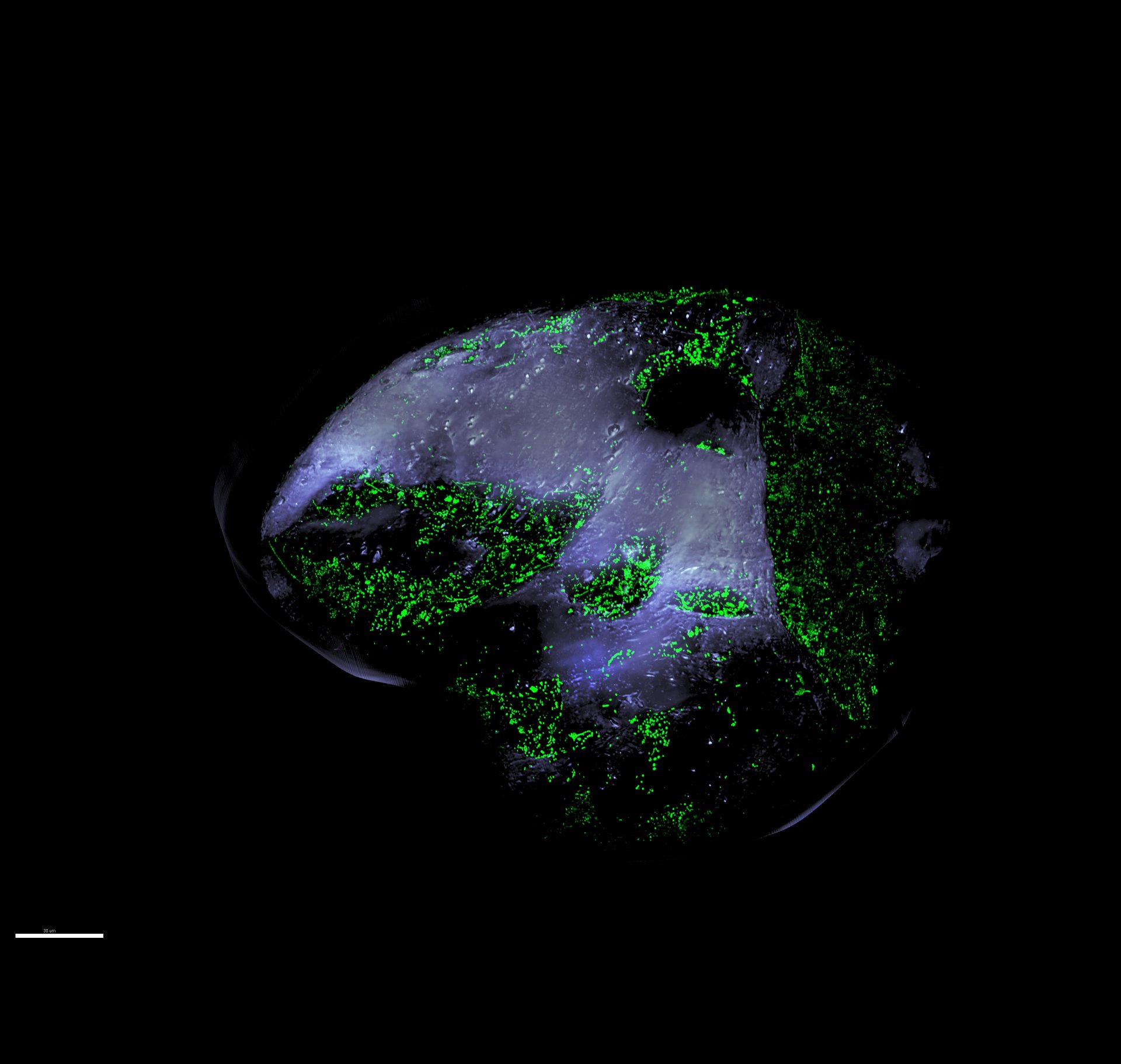 Vergrößerung eines Sandkorns und der Bakterien, die darauf leben. (© Max-Planck-Institut für Marine Mikrobiologie, David Probandt)