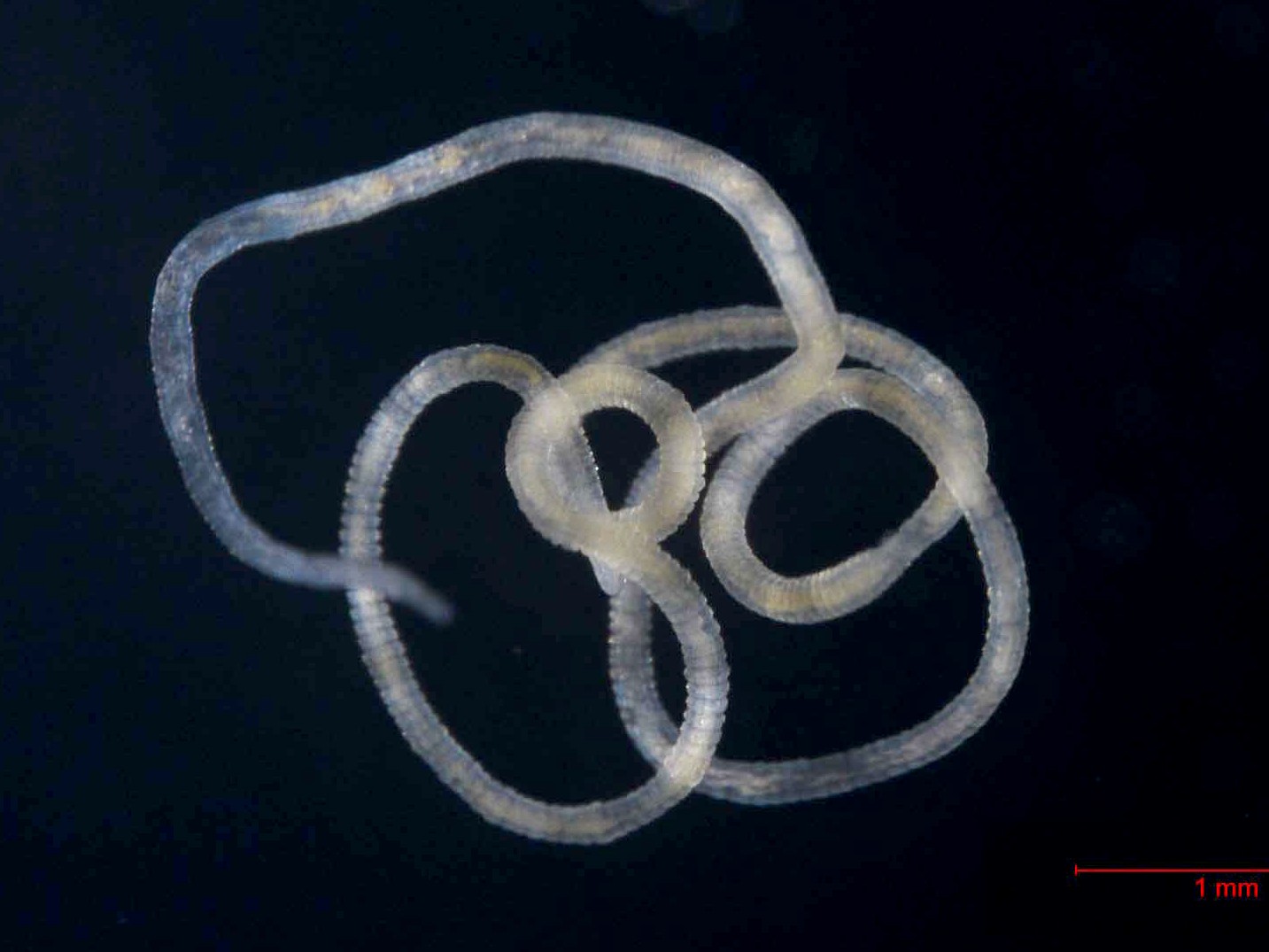 Olavius unter dem Mikroskop (© Max-Planck-Institut für Marine Mikrobiologie/ S. Paulsen)