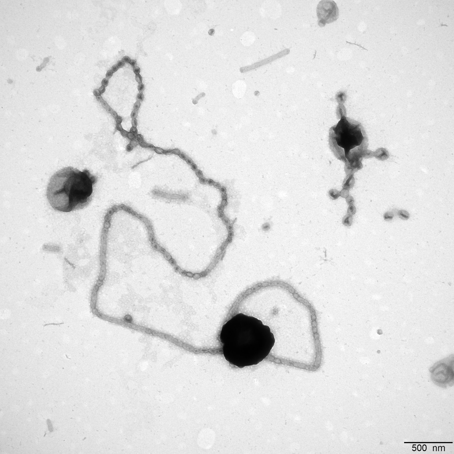 Elektronenmikroskopische Aufnahme einer langen Perlenkette an einem Flavobakterium. (© Max-Planck-Institut für Marine Mikrobiologie / Tanja Fischer)