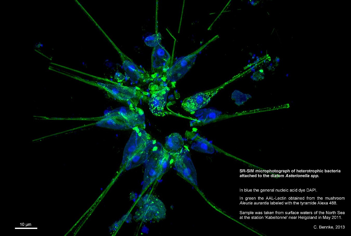 SR-SIM-Aufnahme (© Max-Planck-Institut für Marine Mikrobiologie, C. Bennke)