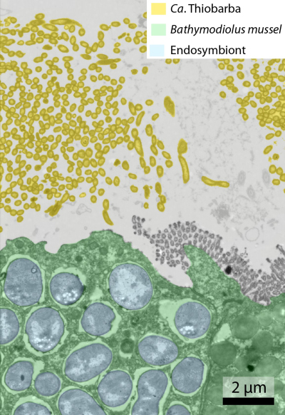 Eingefärbtes Bild aus dem Transmissionselektronenmikroskop; Bathymodiolus-Gewebe in Grün; Zellen von Ca. Thiobarba, die außerhalb der Wirtszellen leben, in Gelb. Der typische Endosymbiont der Bathymodiolus– Muscheln ist hellblau eingefärbt. (© Max-Planck-Institut für Marine Mikrobiologie / Nikolaus Leisch) Eingefärbtes Bild aus dem Transmissionselektronenmikroskop; Bathymodiolus-Gewebe in Grün; Zellen von Ca. Thiobarba, die außerhalb der Wirtszellen leben, in Gelb. Der typische Endosymbiont der Bathymodiolus– Muscheln ist hellblau eingefärbt. (© Max-Planck-Institut für Marine Mikrobiologie / Nikolaus Leisch)
