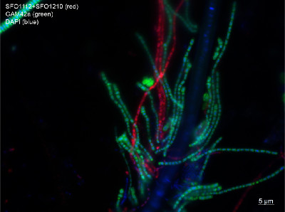 FISH image made by Dimitri Meyer (DOM, University of Vienna) of the sulfide oxidising communities. FISH image made by Dimitri Meyer (DOM, University of Vienna) of the sulfide oxidising communities.
