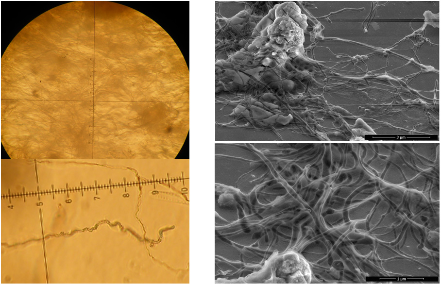 Light microscopy of the sulfur gel (left) and SEM (right). The strange curving is typical for sulfur.wires. Light microscopy of the sulfur gel (left) and SEM (right). The strange curving is typical for sulfur.wires.