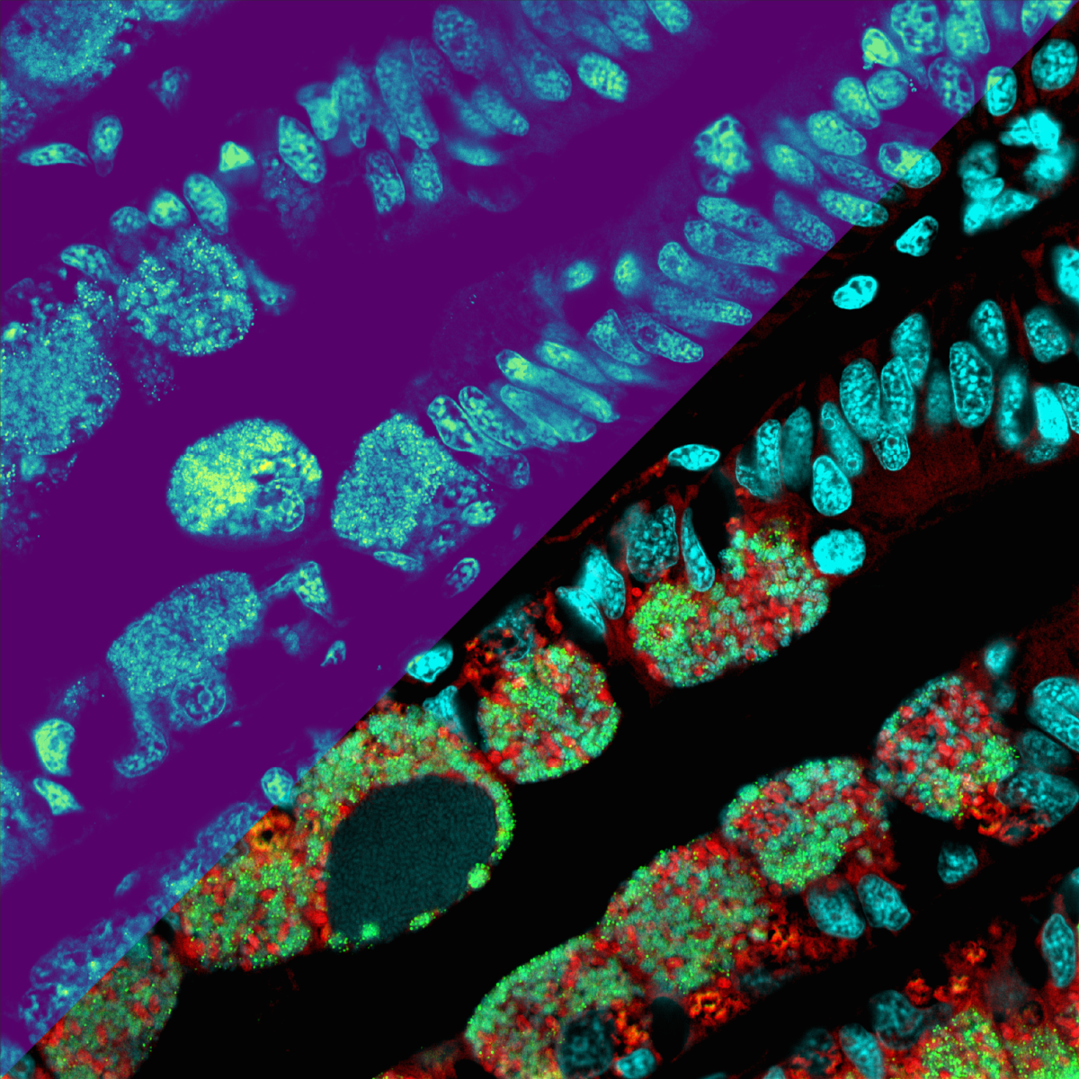The metabolite distributions as a heat map (left part of the figure): the lighter the colour, the higher the concentration of metabolites (microscopy MSI replica for illustration). The right side of the image shows microscopic details of the microbes (in red and green) and the mussel cell nuclei (cyan). (© Max Planck Institute for Marine Microbiology, B. Geier) The metabolite distributions as a heat map (left part of the figure): the lighter the colour, the higher the concentration of metabolites (microscopy MSI replica for illustration). The right side of the image shows microscopic details of the microbes (in red and green) and the mussel cell nuclei (cyan). (© Max Planck Institute for Marine Microbiology, B. Geier)