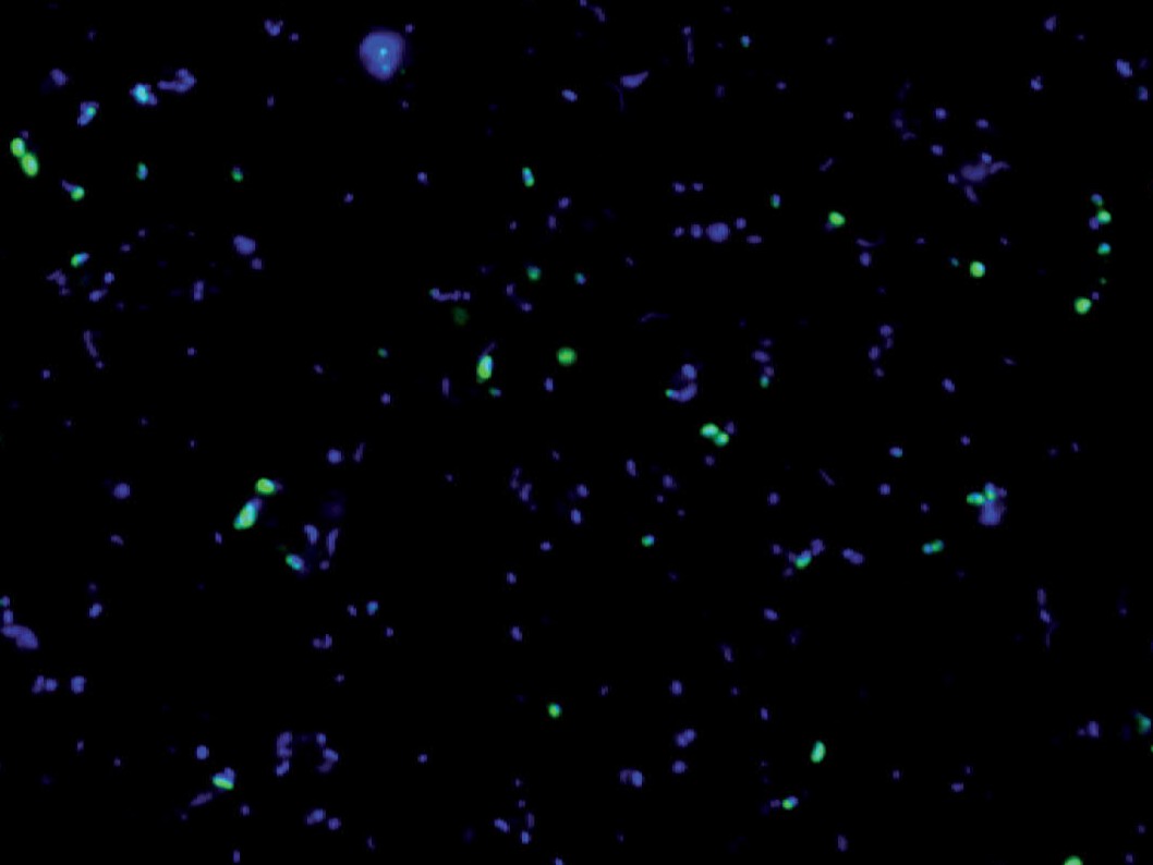 Pictures of ammonia-oxidizing Archaea and nitrite-oxidizing Nitrospinae: The picture on the left shows the abundance of ammonia-oxidizing Archaea (green) and other microorganisms (blue). The picture on the right shows the abundance of nitrite-oxidizing Ni