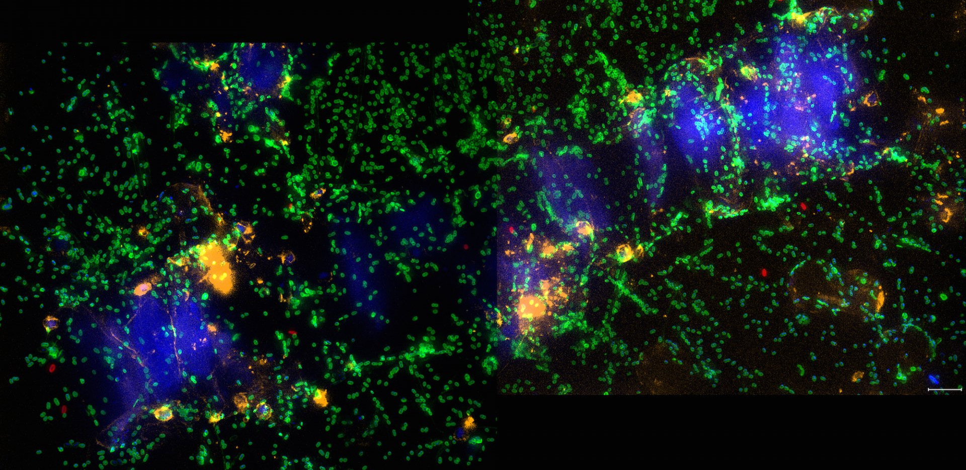 Algal cells (blue) surrounded by bacteria (green) devouring their sweet contents. (© Max Planck Institute for Marine Microbiology / I. Bakenhus)