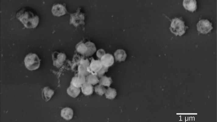 Electron micrograph of lentimonas, the bacteria of this study. The cells are small round cocci and grow as an aggregate.
