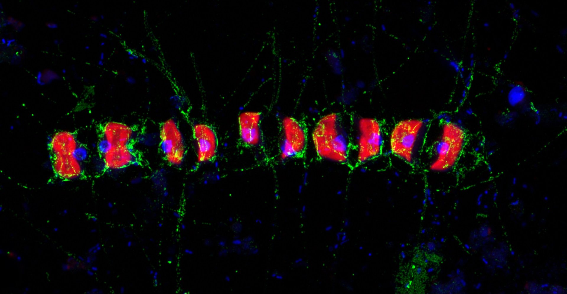 This Airyscan super-resolution image shows that fucose-containing sulphated polysaccharide, or FCSP, (in green) occurred around the cells of the chain-forming diatom Chaetoceros socialis and their spines. DAPI (blue) and diatom auto fluorescence (red). Sample collected during the 2016 spring diatom bloom period in Helgoland. (© Max Planck Institute for Marine Microbiology/S. Vidal-Melgosa)