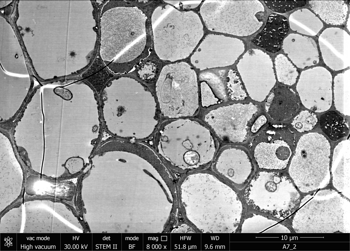 STEM image of a thin section of a piece of seagrass root. (© Max Planck Institute for Marine Microbiology, S. Littmann) STEM image of a thin section of a piece of seagrass root. (© Max Planck Institute for Marine Microbiology, S. Littmann)