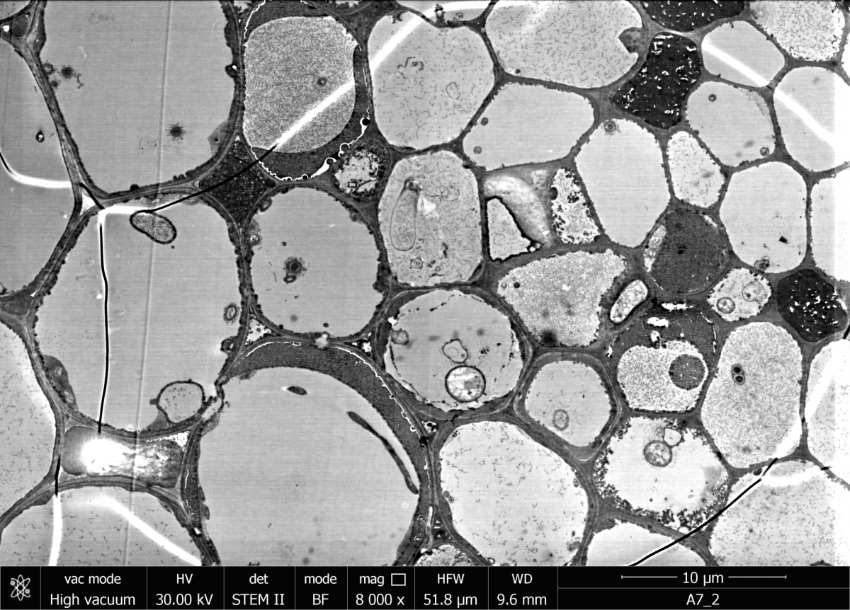 STEM image of a thin section of a piece of seagrass root. (© Max Planck Institute for Marine Microbiology, S. Littmann)