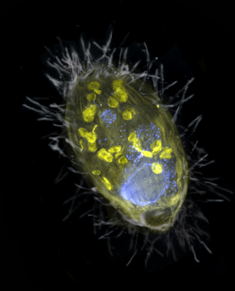 Denitrifying endosymbiont Candidatus Azoamicus ciliaticola (in yellow) inside its ciliate host.