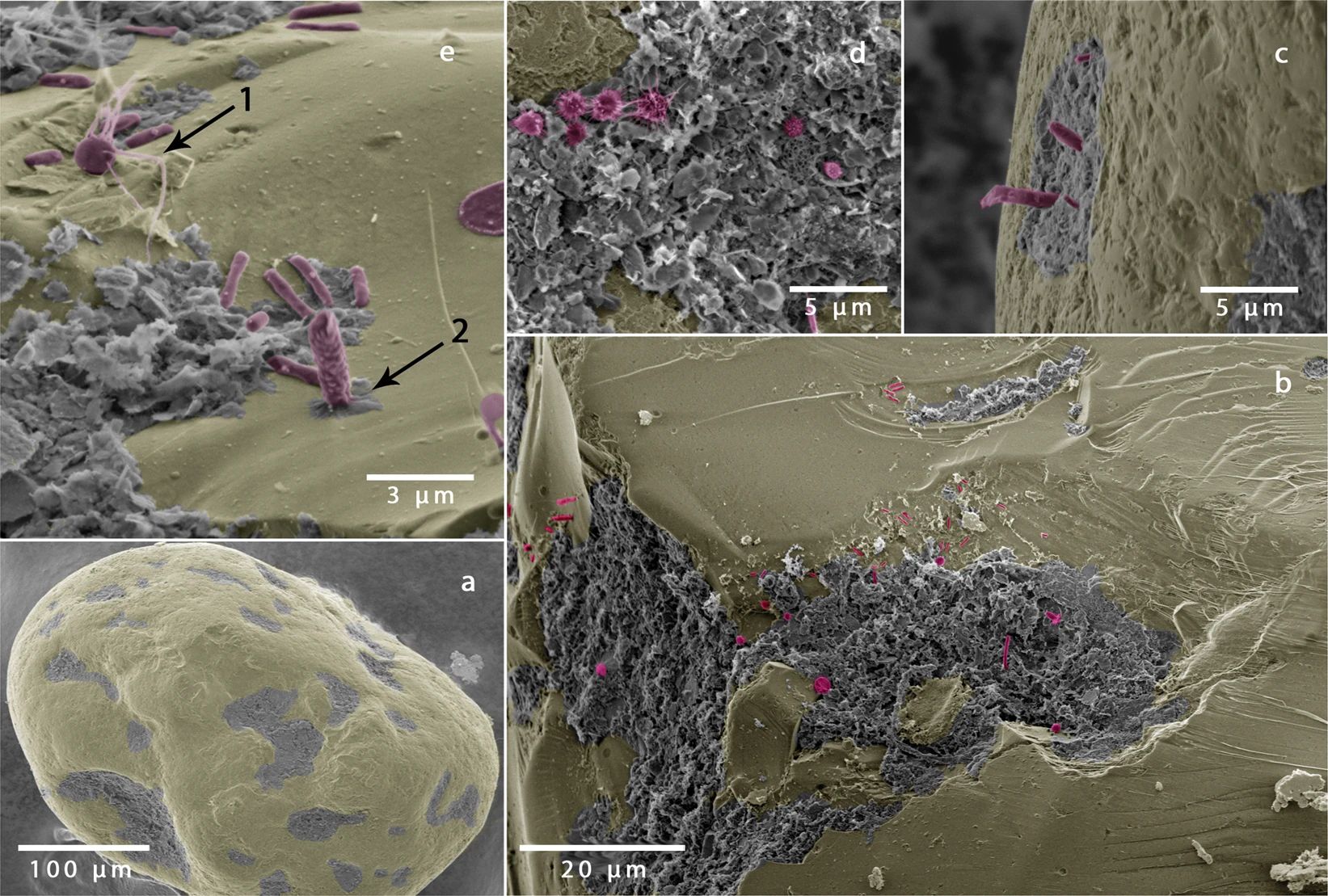 Microbes on a sand grain