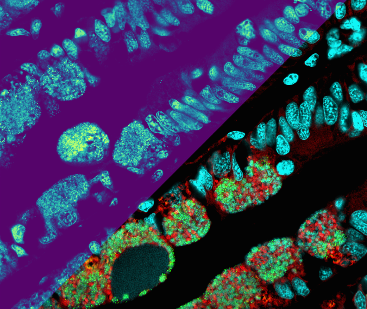 Metabolite distributions shown as a heatmap on the upper left part of the picture: The brighter the color, the higher the metabolite concentration (microscopy-MSI mockup for illustration). The lower right side of the picture displays microscopic details o