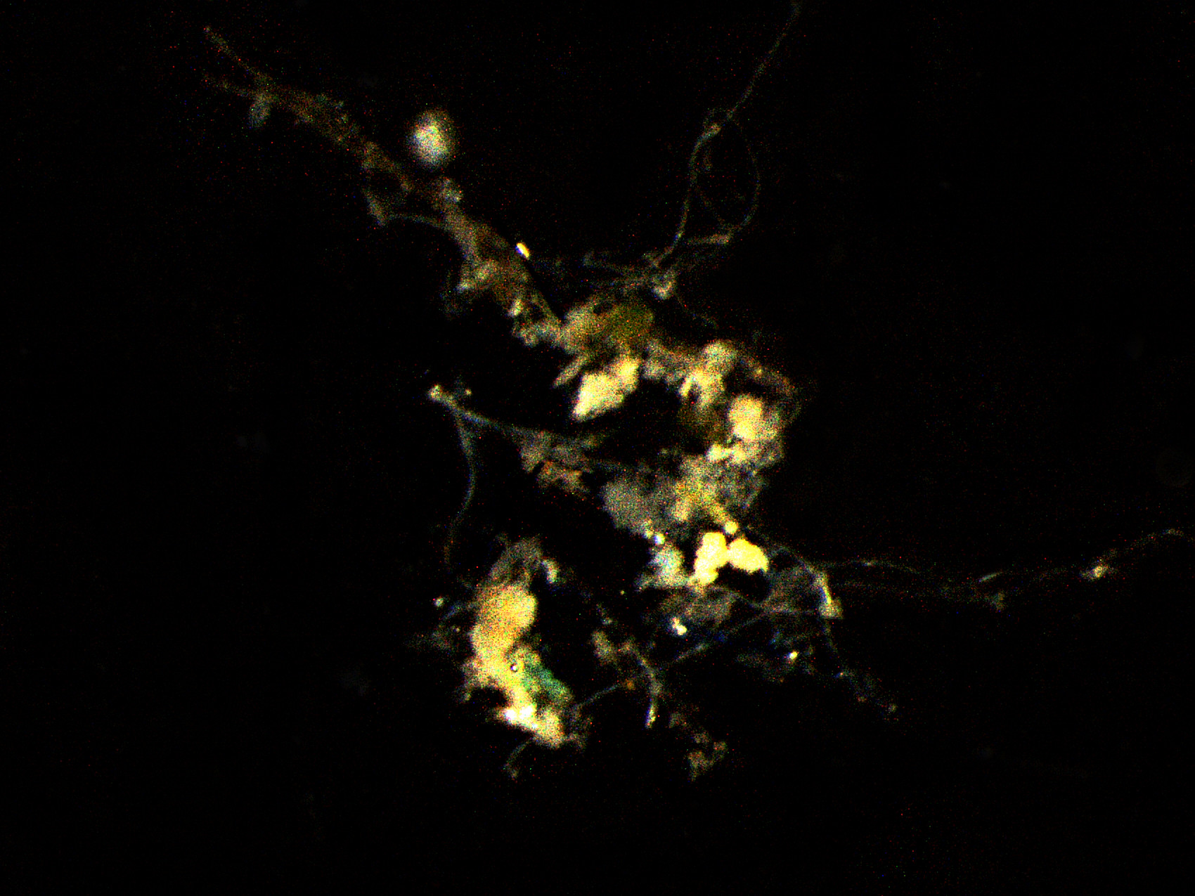 Organische Partikel im Meer - der Meeresschnee - haben bizarre Formen. (©Max-Planck-Institut für Marine Mikrobiologie, C. Karthäuser und S. Ahmerkamp)