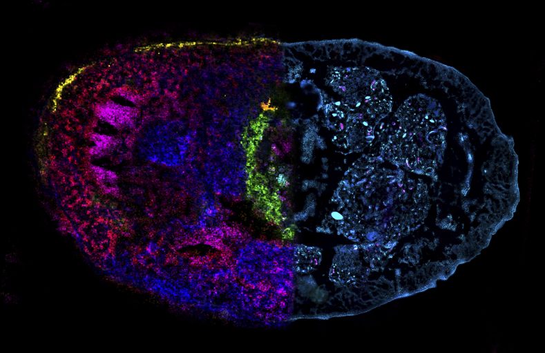 The image shows a cross-section of an entire earthworm, images with two techniques: Mass spectrometry imaging (left) and fluorescence microscopy (right). The different colors of the mass spectrometry imaging data show the distribution of different metabolites in the tissue, whereas the fluorescence microscopy shows the tissue structures underlying the chemical distributions (© Max Planck Institute for Marine Microbiology/B. Geier)