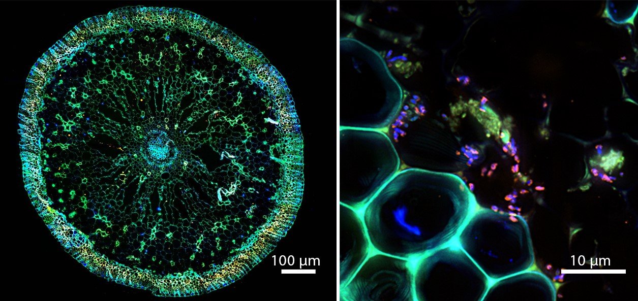 Symbiosis under the microscope