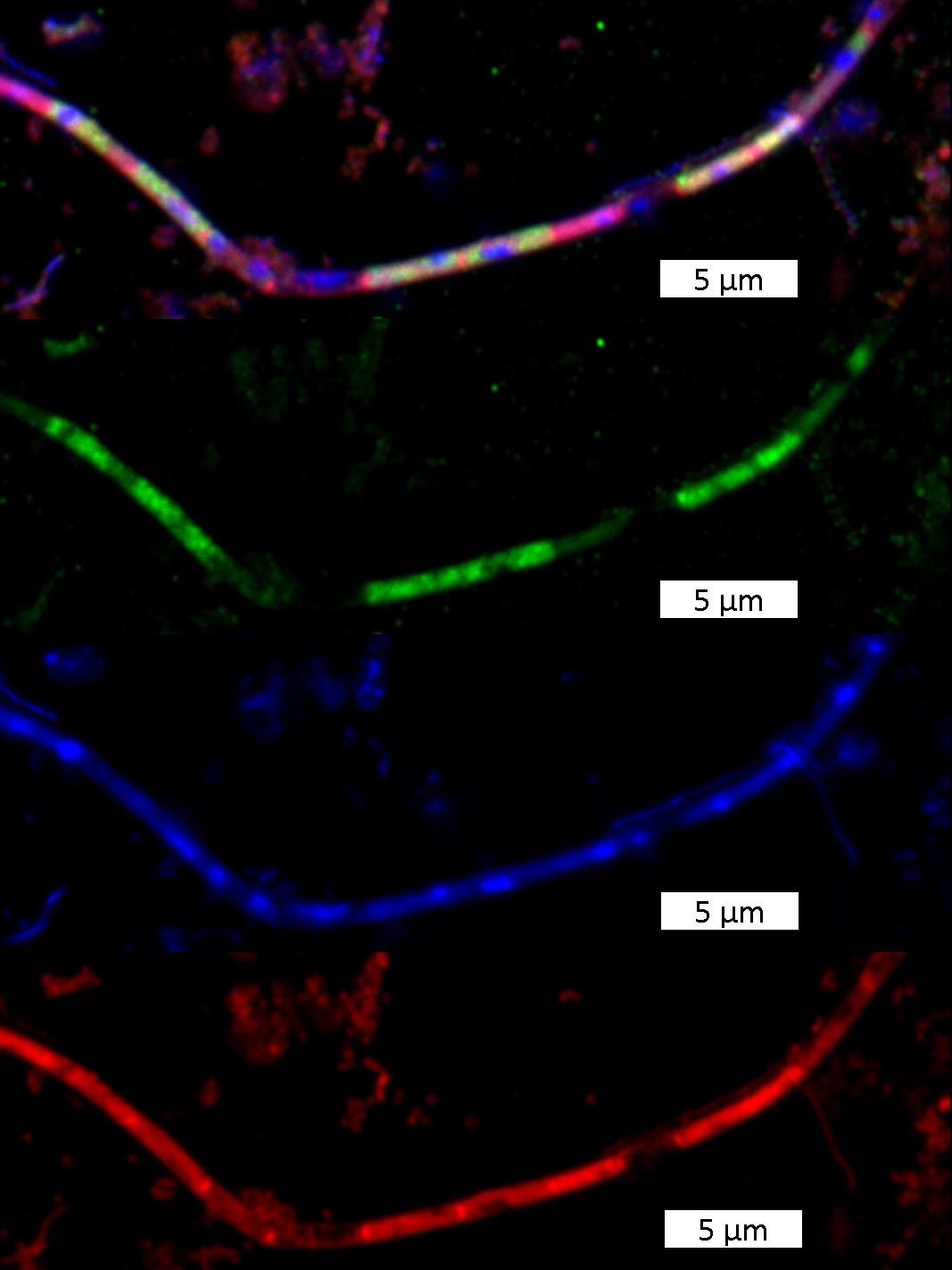 Images of Methanosaeta, a filamentous methanogenic archaeon, from the fluorescence microscope. Images of Methanosaeta, a filamentous methanogenic archaeon, from the fluorescence microscope.